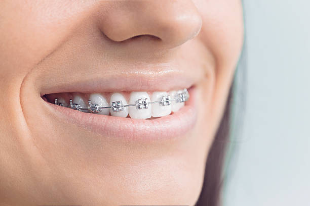 Laser Dentistry in Elburn, IL